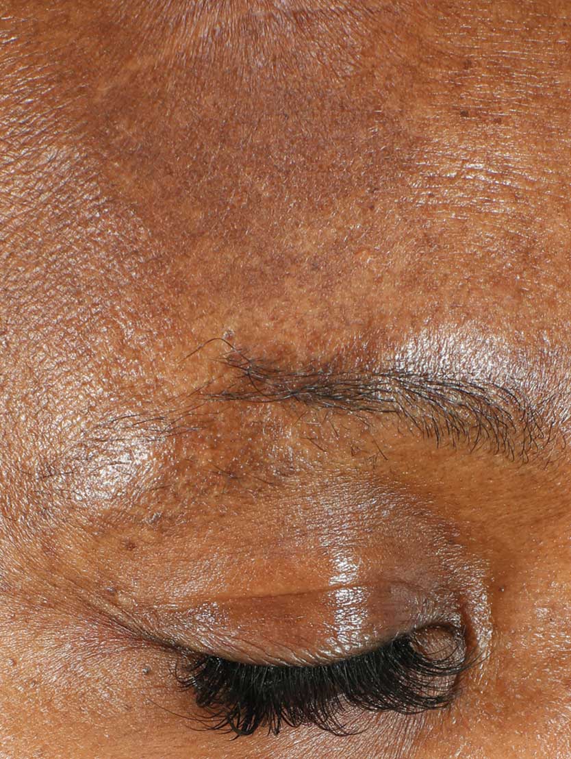 Close up of face after using product