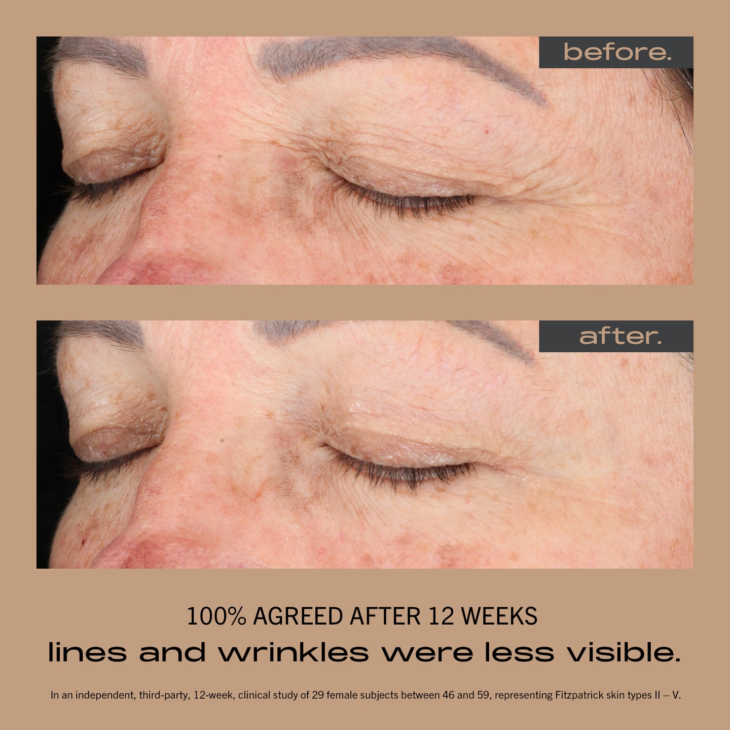 MATTER OF FACT SKINCARE BRIGHTENING AND FIRMING SERUM image of face before and after using