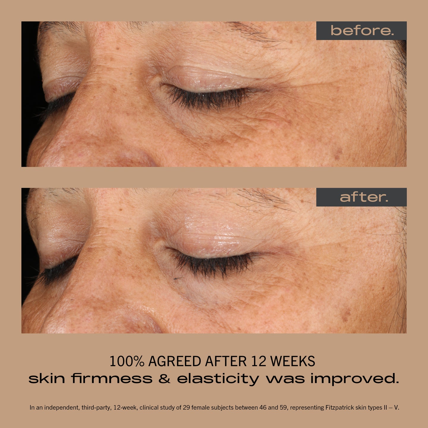 MATTER OF FACT SKINCARE BRIGHTENING AND FIRMING SERUM image of face before and after using
