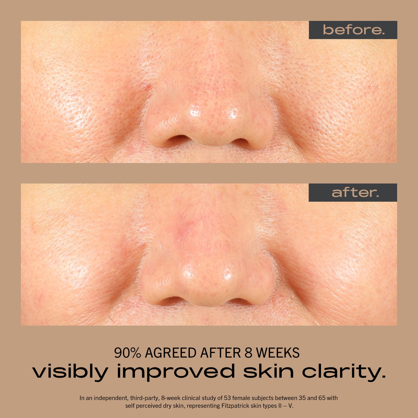 MATTER OF FACT SKINCARE RESURFACING AND HYDRATING SERUM image of face before and after using