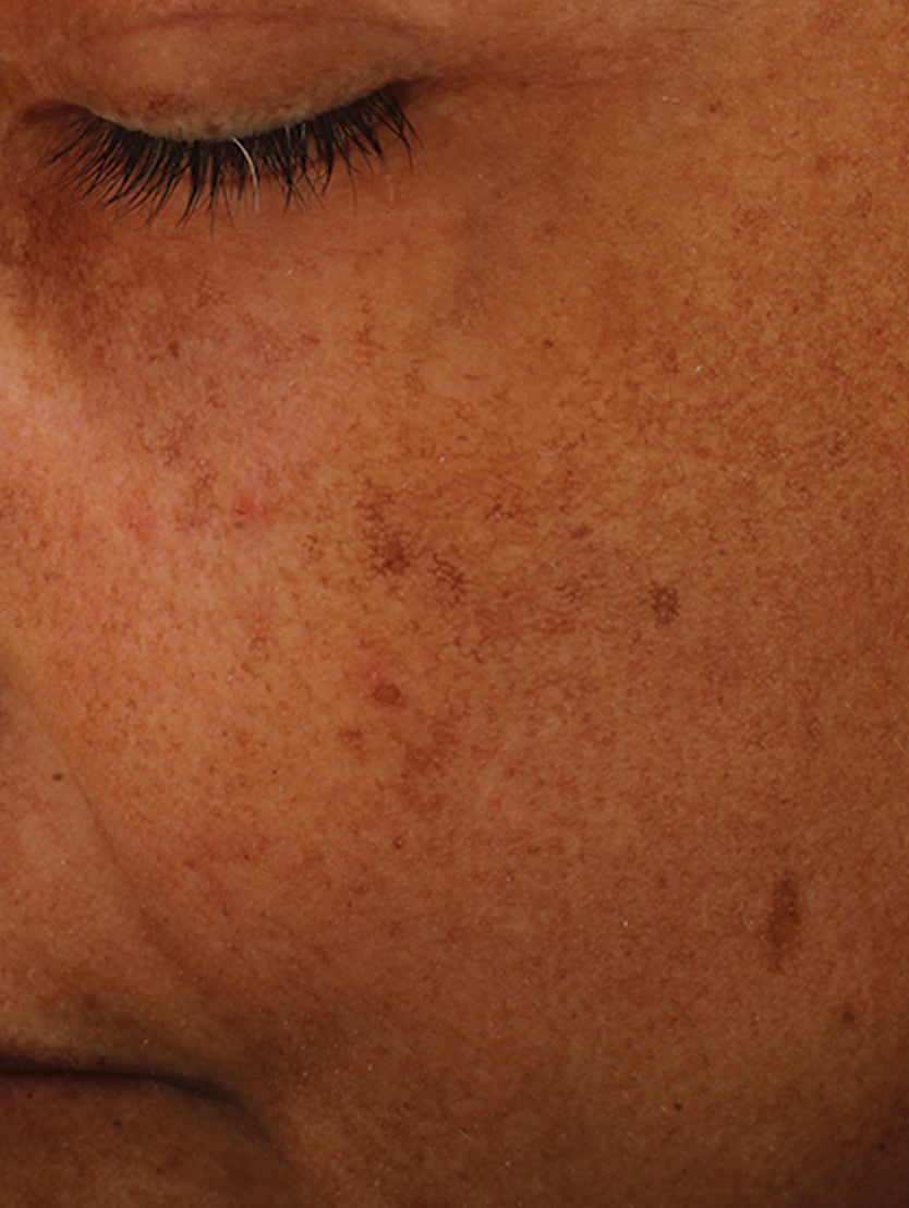 Close up of face after using product