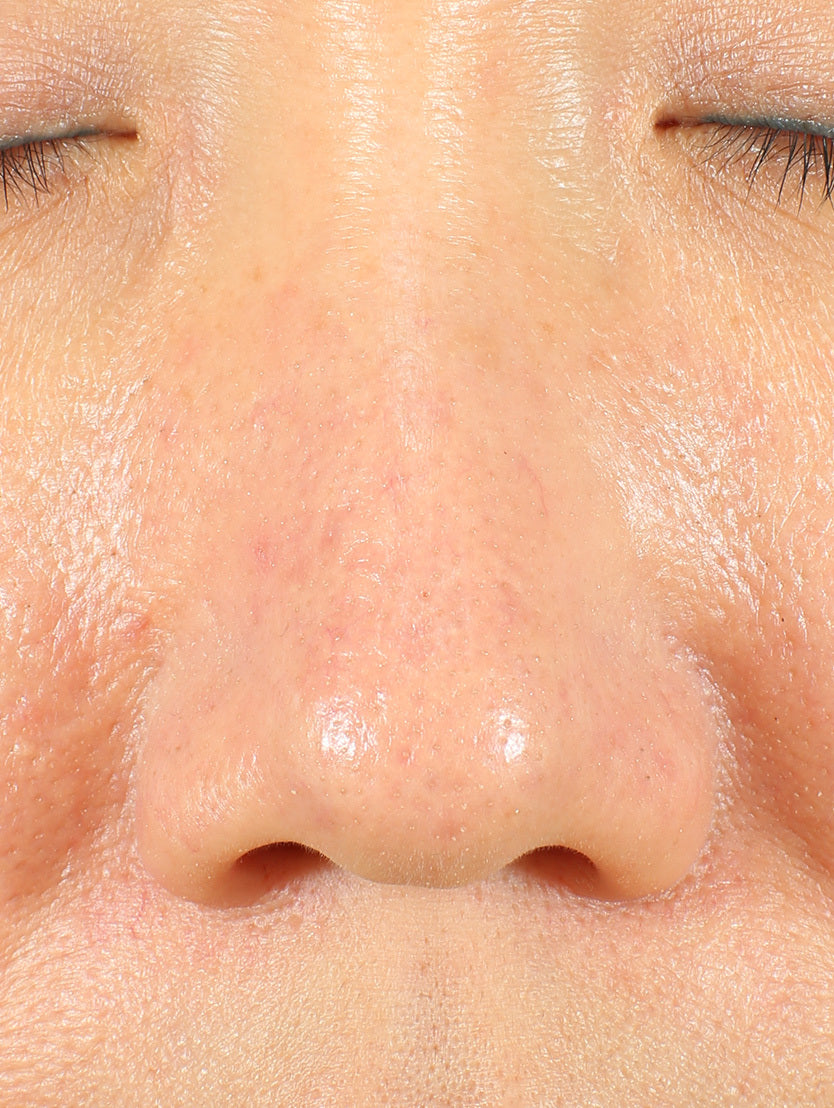 Close up of face focusing on nose after using product
