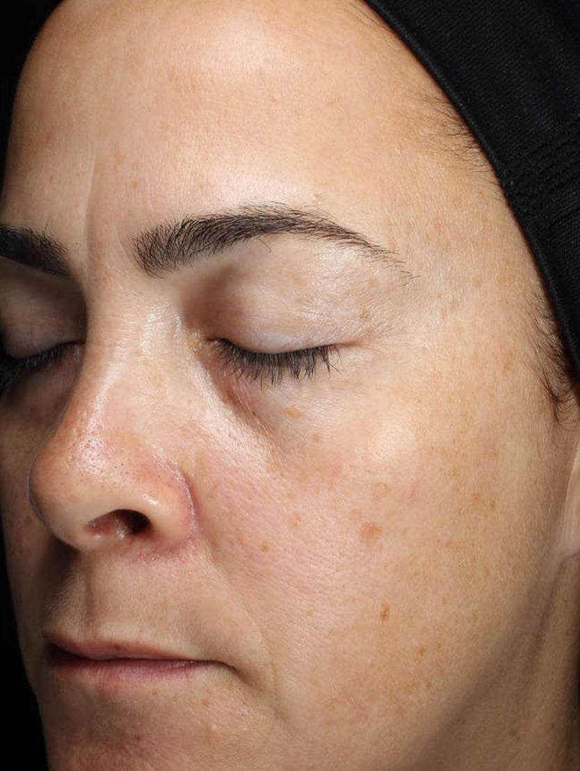 Image of face after using product
