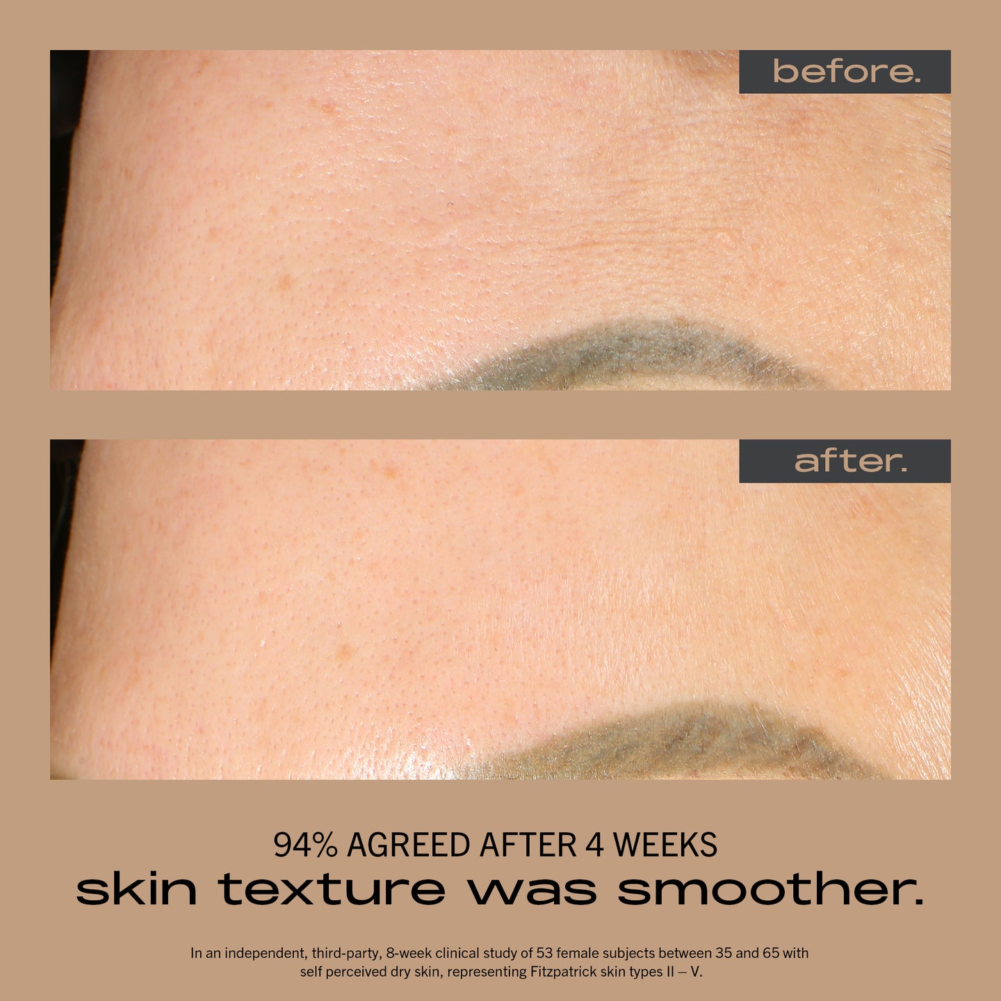 MATTER OF FACT SKINCARE RESURFACING AND HYDRATING SERUM image of face before and after using