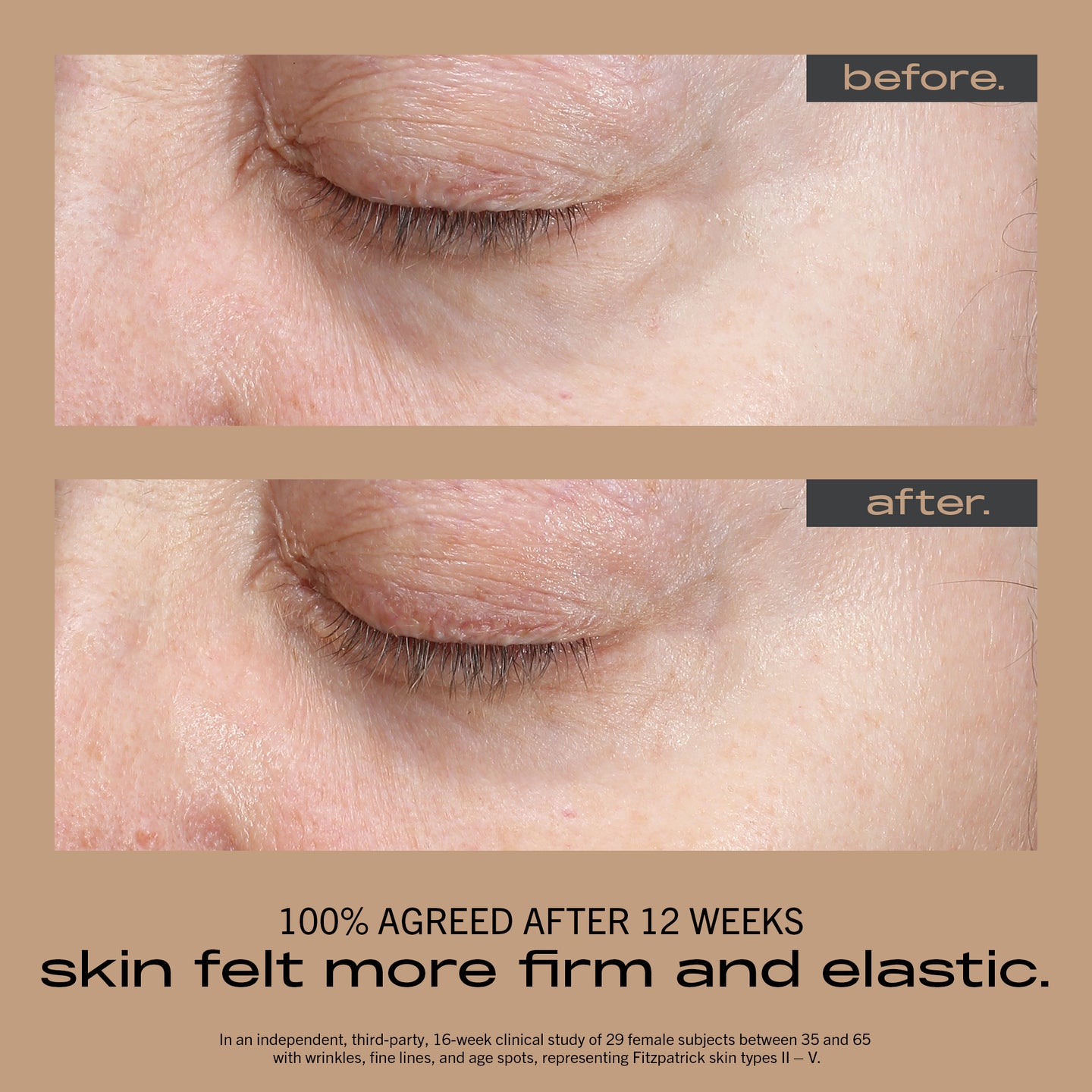 MATTER OF FACT SKINCARE WRINKLE + TEXTURE CONCENTRATE image of face before and after using
