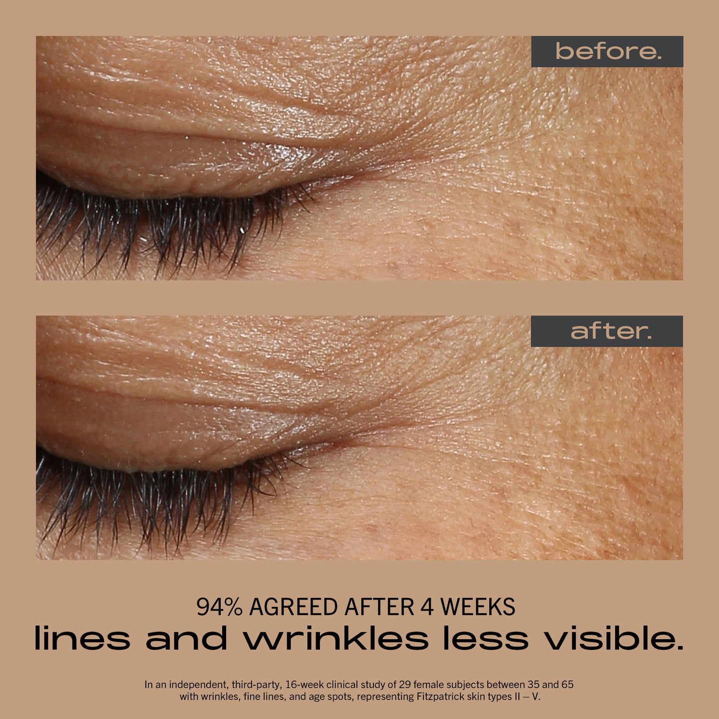 MATTER OF FACT SKINCARE WRINKLE AND TEXTURE CONCENTRATE before and after shot of an eye area